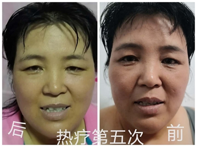 顾客反映：在睡吧热疗自己变美了（一）