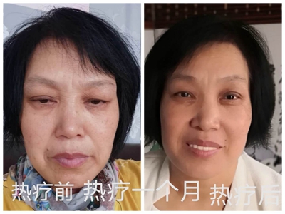 顾客反映：在睡吧热疗自己变美了（二）