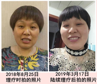 顾客反映：在睡吧热疗自己变美了（三）